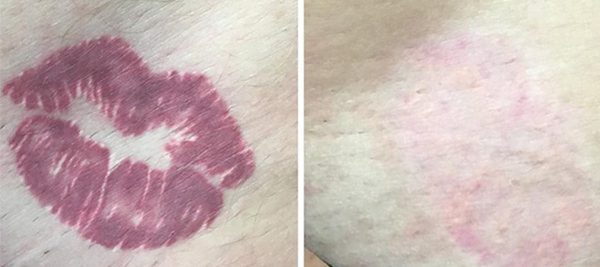 Tattoo-2